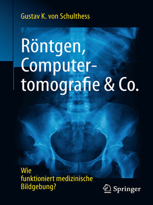 cover image of Röntgen, Computertomografie & Co.